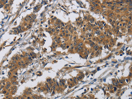 Claudin 8 Polyclonal Antibody Store at -20°C