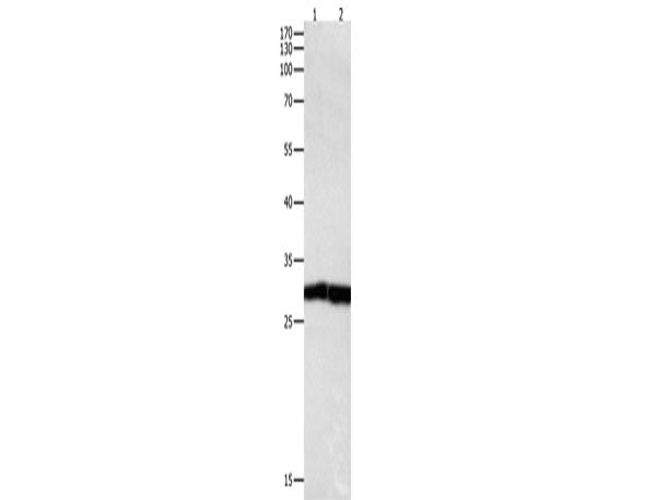 MKP-3 Polyclonal Antibody Store at -20°C