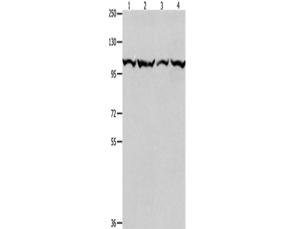 MCM3 Polyclonal Antibody Store at -20°C