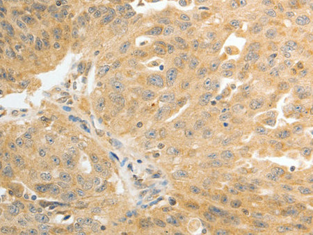 AKR1C1 Polyclonal Antibody Store at -20°C
