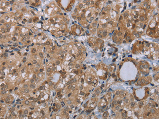 LIMK1 Polyclonal Antibody Store at -20°C