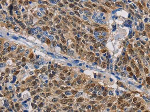 GSTA2 Polyclonal Antibody Store at -20°C