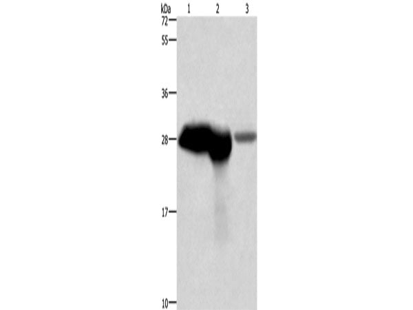 CALB1 Polyclonal Antibody Store at -20°C