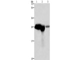 CALB1 Polyclonal Antibody Store at -20°C