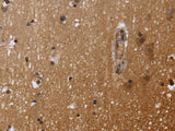 FHL3 Polyclonal Antibody Store at -20°C