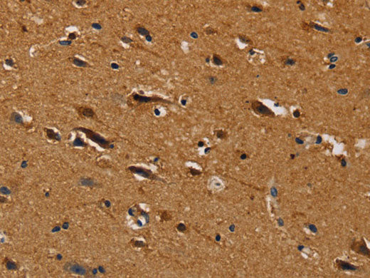 CENPU Polyclonal Antibody