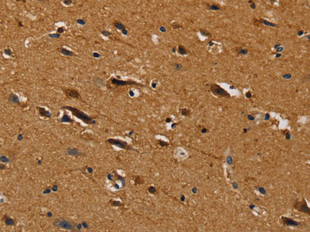 CENPU Polyclonal Antibody