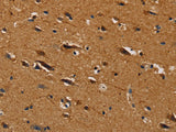 CENPU Polyclonal Antibody