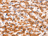 FBLN1 Polyclonal Antibody Store at -20°C
