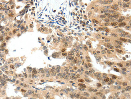 TOP2A Polyclonal Antibody Store at -20°C