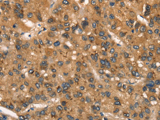 CSTB Polyclonal Antibody Store at -20°C