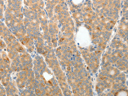 TEP1 Polyclonal Antibody Store at -20°C