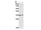 SFTPA1 Polyclonal Antibody