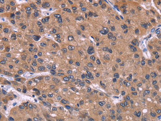 HSD11B2 Polyclonal Antibody Store at -20°C