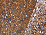 GUK1 Polyclonal Antibody Store at -20°C