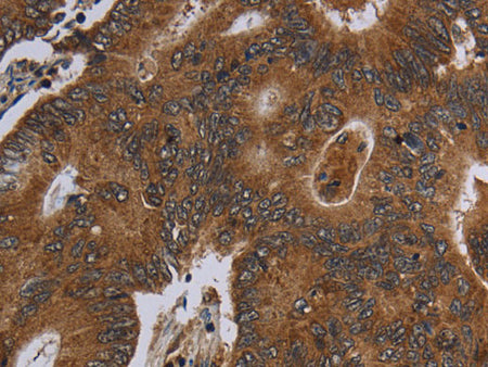 HSD17B13 Polyclonal Antibody Store at -20°C