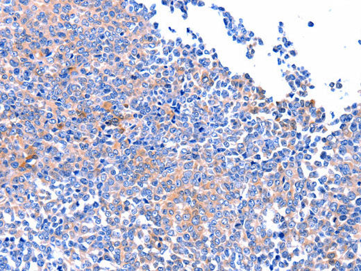 FAK Polyclonal Antibody Store at -20°C