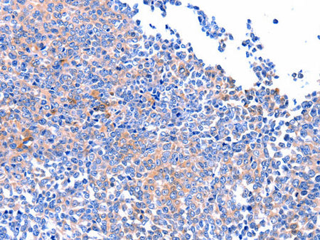 FAK Polyclonal Antibody Store at -20°C