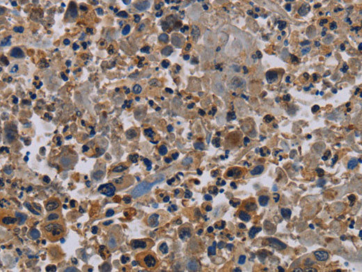 NECTIN4 Polyclonal Antibody Store at -20°C
