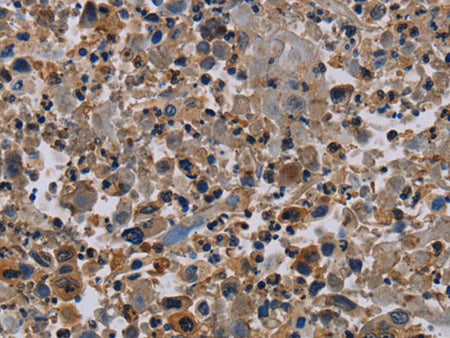 NECTIN4 Polyclonal Antibody Store at -20°C