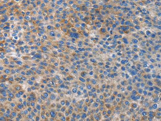ATG4B Polyclonal Antibody Host Rabbit