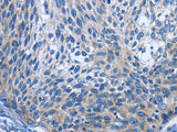 IL2RB Polyclonal Antibody Store at -20°C