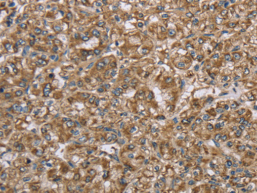 CERS4 Polyclonal Antibody Store at -20°C
