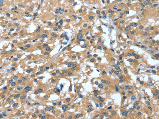 DTX1 Polyclonal Antibody Store at -20°C