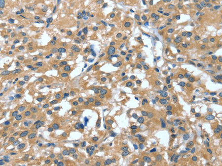 DTX1 Polyclonal Antibody Store at -20°C