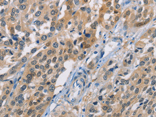CBR1 Polyclonal Antibody Store at -20°C