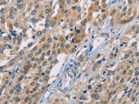 CBR1 Polyclonal Antibody Store at -20°C