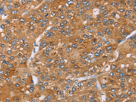 PAICS Polyclonal Antibody Store at -20°C