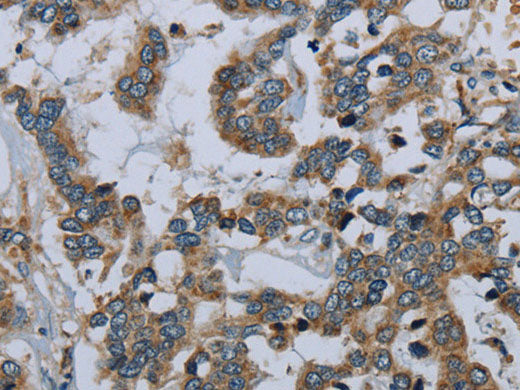 PCK2 Polyclonal Antibody Store at -20°C