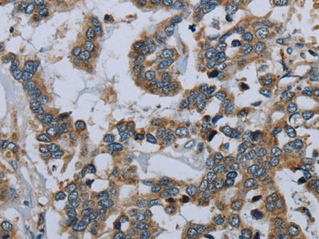 PCK2 Polyclonal Antibody Store at -20°C