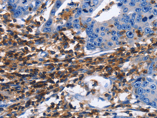 CD45 Polyclonal Antibody Store at -20°C