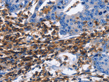 CD45 Polyclonal Antibody Store at -20°C