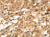 DIRAS1 Polyclonal Antibody Store at -20°C