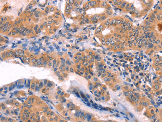 NCEH1 Polyclonal Antibody Store at -20°C