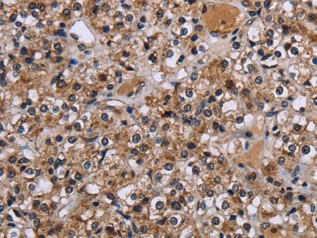 c-Rel Polyclonal Antibody Store at -20°C