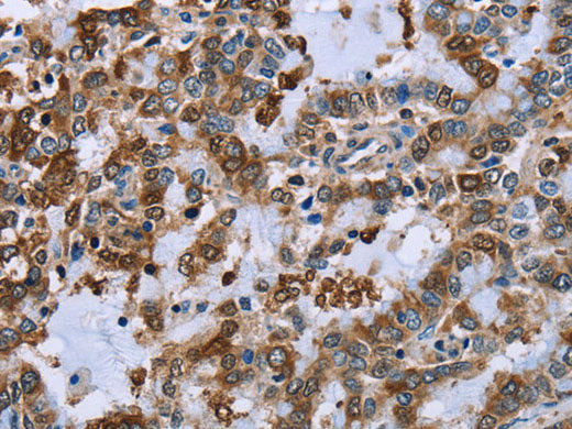 IMPDH2 Polyclonal Antibody Store at -20°C
