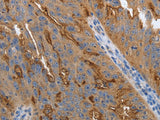 SLC34A2 Polyclonal Antibody Store at -20°C