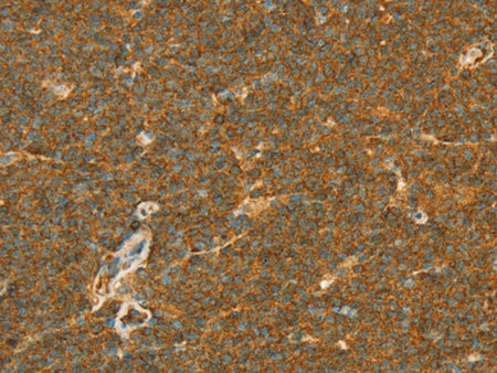 APOL2 Polyclonal Antibody Store at -20°C