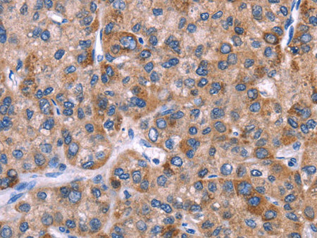 EVC2 Polyclonal Antibody Store at -20°C