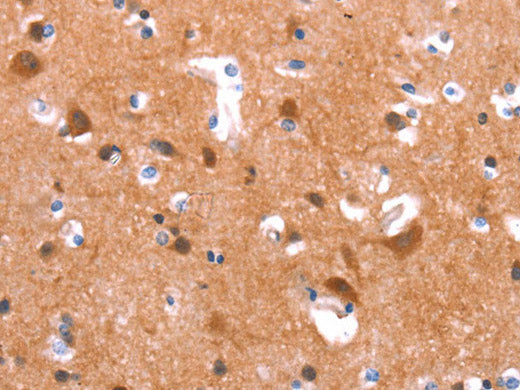 GAS8 Polyclonal Antibody Store at -20°C