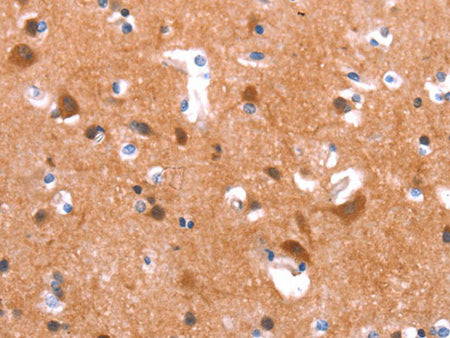GAS8 Polyclonal Antibody Store at -20°C