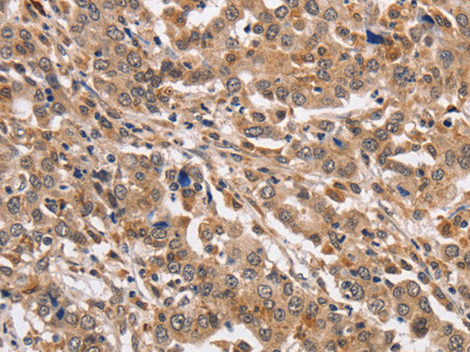 KCNG2 Polyclonal Antibody Store at -20°C