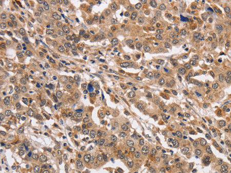 KCNG2 Polyclonal Antibody Store at -20°C