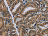 NAT10 Polyclonal Antibody