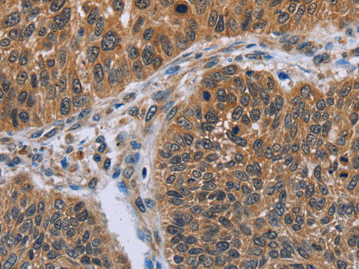 IHH Polyclonal Antibody Store at -20°C