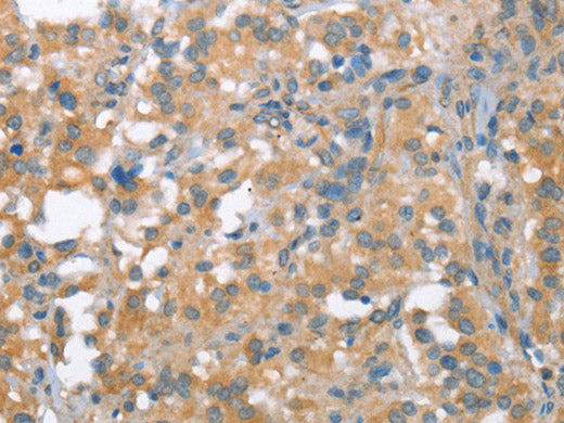 NLRP7 Polyclonal Antibody Store at -20°C